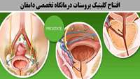 شروع به کار کلینیک پروستات