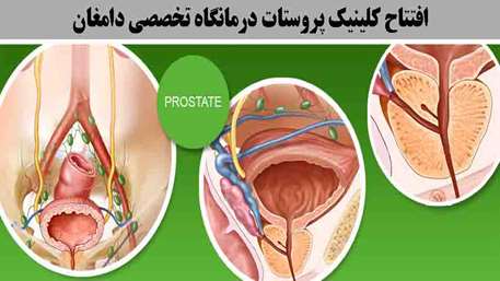  کلینیک ویژه پروستات